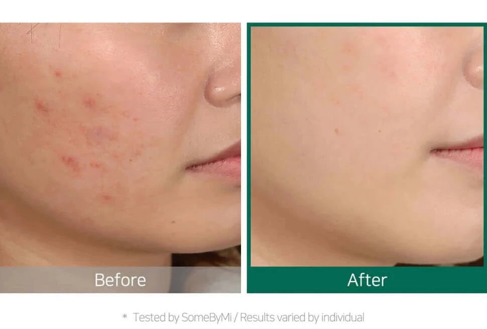 SOS līdzeklis Some By Mi 30 days Miracle Tea Tree Clear Spot Oil