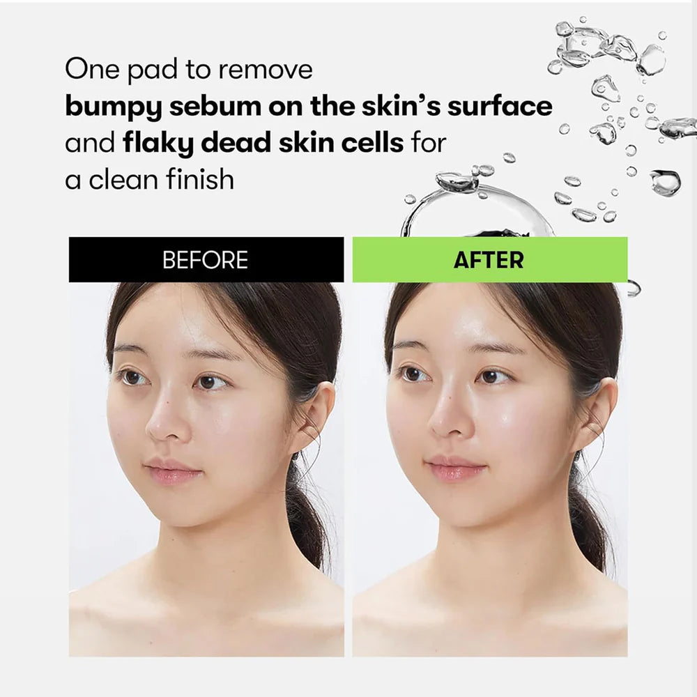 Ādu atjaunojoši spilventiņi ar gāzētu ūdeni VT Cosmetics Reedle Shot Synergy Sparkling Toner Pad