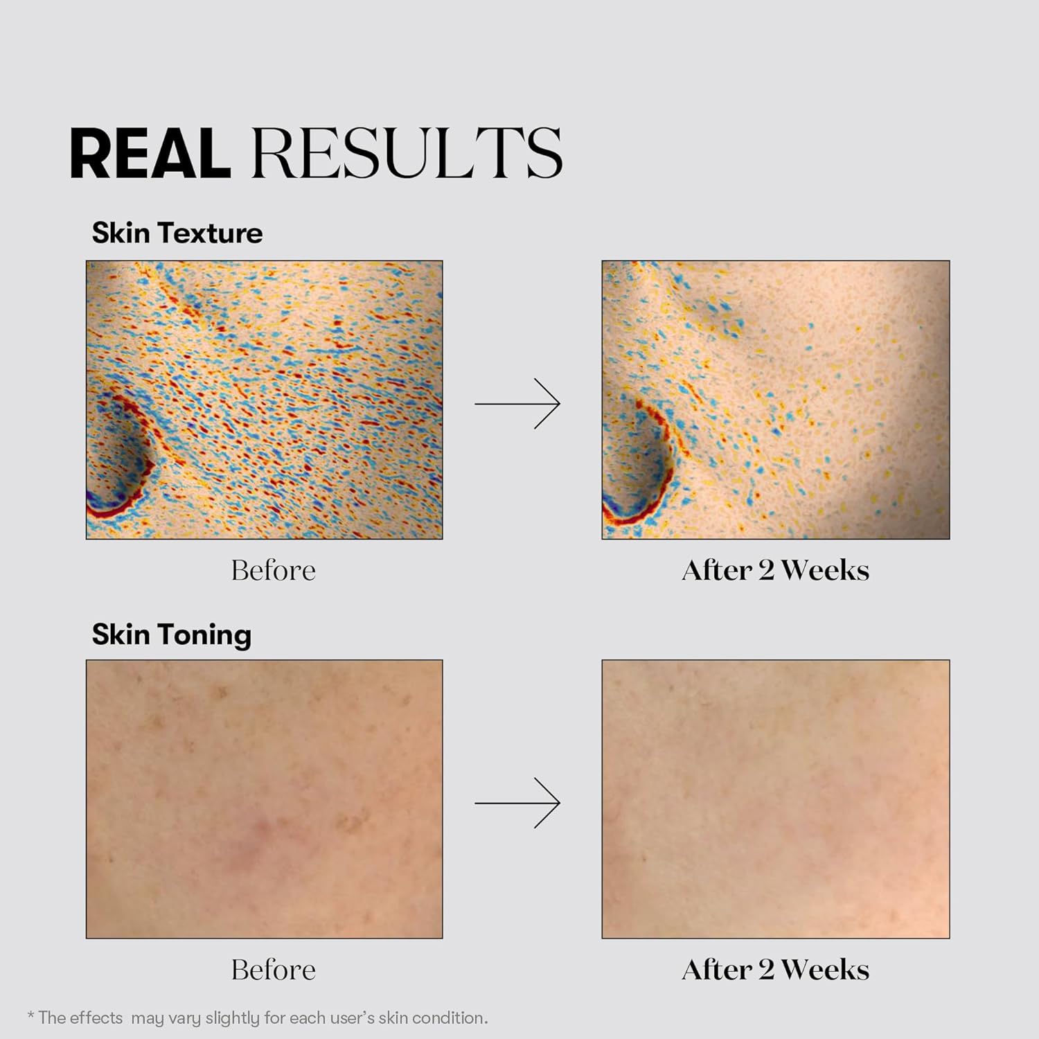 Kapsulu esence pigmentācijas plankumu novēršanai VT Cosmetics TX-Toning Essence 1000 Shot