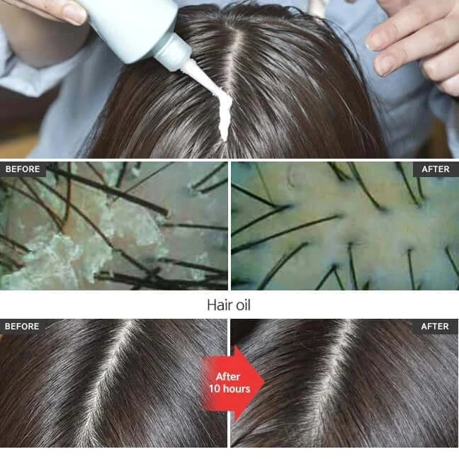 Līdzeklis dziļai galvas ādas attīrīšanai CP-1 Head Spa Scalp Scaler