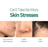 SOS līdzeklis Some By Mi 30 days Miracle Tea Tree Clear Spot Oil