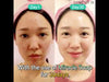 Attīrošas ziepes ar skābēm problemātiskai ādai Some By Mi AHA-BHA-PHA 30 Days Miracle Cleansing BarSome By Mi 